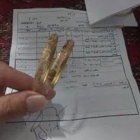 طلا