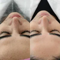 فیشیال تخصصی صورت،شهرک توحید