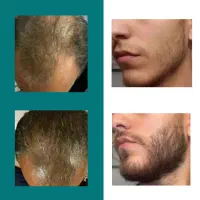 برگ برنده تو