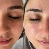 خدمات تتو بدن و صورت و فشیال تخصصی پوست