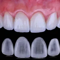 آموزش صفرتاصد دندانسازی و دندانپزشکی