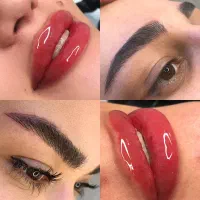 فیبروز میکروبلیدینگ شیدینگ