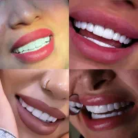 آموزش ونیز کامپوزیت