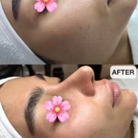 آفر ویژه خدمات تخصصی پوست
