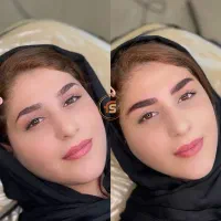 آموزش و‌خدمات میکروبلیدینگ