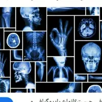 خرید عکس رادیولوژی باطله
