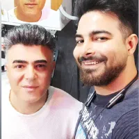 پروتز مو