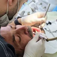 خدمات دندانپزشکی، با امکان پرداخت مرحله ای