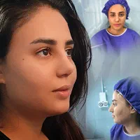 جراحی بینی در تهران برای مراجعین کاشان/۴۳میلیون