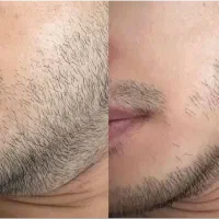 بمب رویش