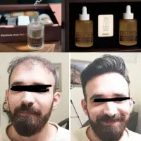 محلول آلمانی سولوژن