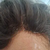 کلاه گیس