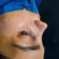 عمل جراحی زیبایی بینی.لیفت صورت.اندام