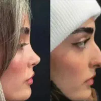 عمل بینی با تعرفه دولتی
