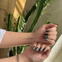 ترمیم و لاکژل ۴۹۰ برای اولین مراجعه