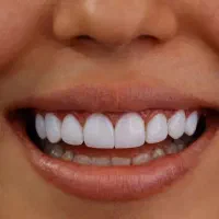 نوبت گیری تامین اجتماعی دندان پزشکی و...