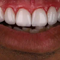 نیاز به دستیار دندانپزشک