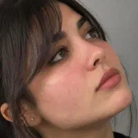 عمل بینی/ رینو پلاستی/ اقساط/ تضمینی