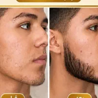 کمتر از سه هفته موهاتو تقویت کن