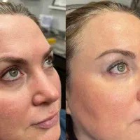 کلینیک تخصصی زیرچشم/اسلامشهر