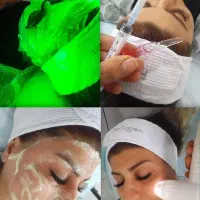 مدل فیشال و کاشت مژه