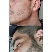 تضمین میدم ریشات با این پک در میاد