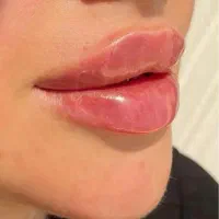 لب فانتزی