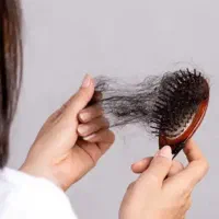 خداحافظی با کاشت مو زیبایی حق شماست