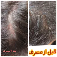 چاقی لاغری ریزش مو درد ارتروز