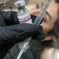 بوتاکس طبیعی