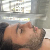 جراحی بینی دکتر اسدالله پور