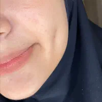 چال گونه وپیرسینگ