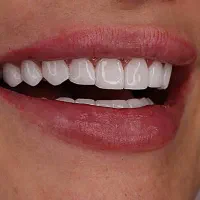 دستیار دندانپزشکی