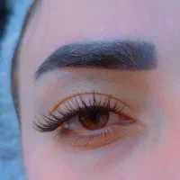 کاشت مژه هیدن (تخفیف ویژه به صورت محدود)