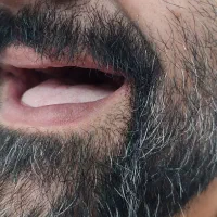 دندان مصنوعی. دندانسازی .اوردنچراقساط ده تومان