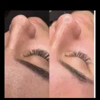 فیشیال تخصصی