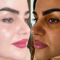 سفید کننده فوری