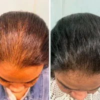 پرپشتی از اینجا شروع میشه