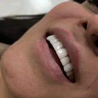 خدمات دنداپزشکی و کامپوزیت دندان