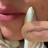 خدمات تخصصی  ژل و بوتاکس