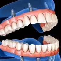 کلینیک تخصصی دندانپزشکی قطب ایمپلنت  منتخب کشور