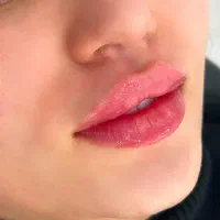 ژل لب با فرم دهی طبیعی / با شرایط ویژه در اصفهان