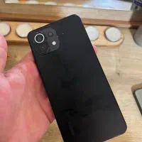 شیامی mi 11lite
