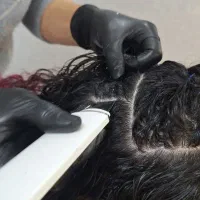 پاکسازی کف سر  .اسکالپ