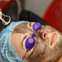 هایفو لاغری کربن تراپی فشیال پی ار پی امبدینگ