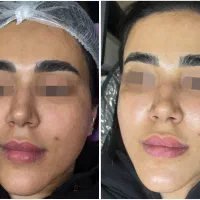 خدمات تخصصی اسکین‌تراپی