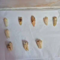 دندان