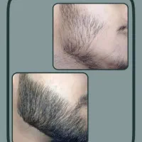 هنوزم ریشات در نیمده