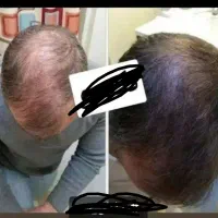 زیبایی با محصولات گیاهی تکسو