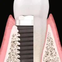 استخدام دستیار دندانپزشک
